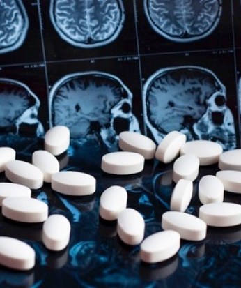 Një terapi me antitrupa mund të bllokojë përparimin e Alzheimerit
